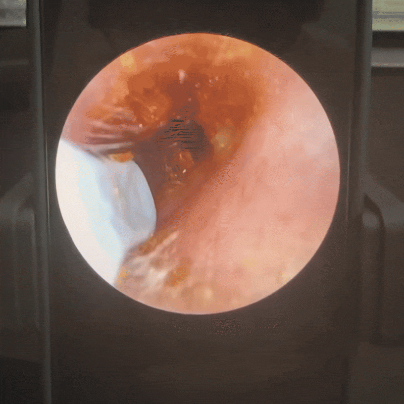 VisioEar: Doctor Approved Ear Health Technology